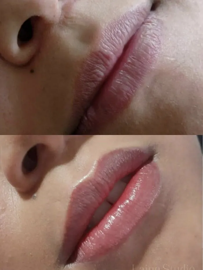 Antes e depois de micropigmentação labial